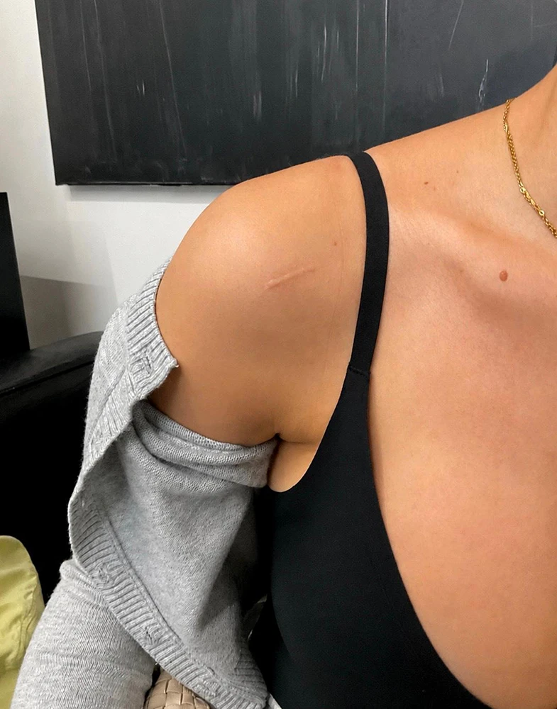 Cover-up work