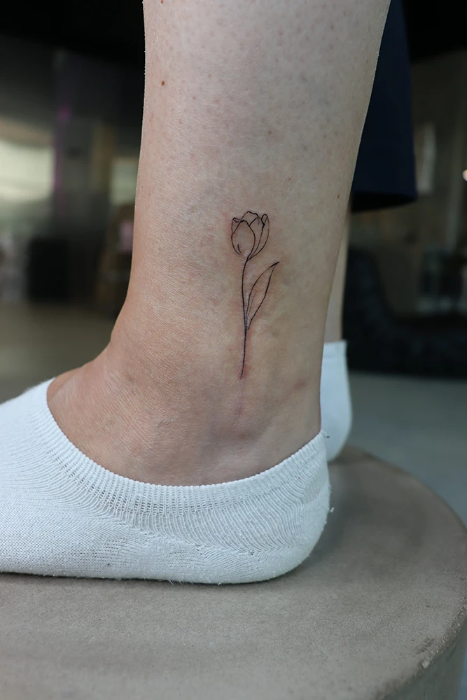 Scar and stretch mark coverage